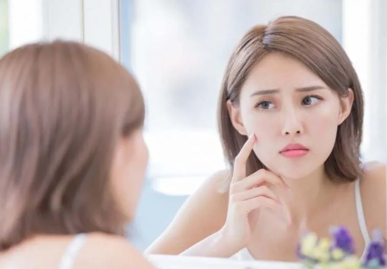 Cách trị thâm mụn tại nhà