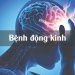 Bệnh Động Kinh và những điều cần biết
