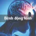 Bệnh Động Kinh và những điều cần biết