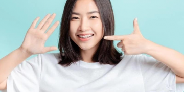 Niềng răng là gì? Địa chỉ niềng răng tốt nhất hiện nay